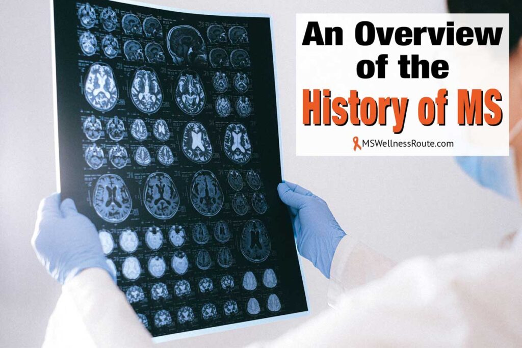 Technician looking at an MRI with overlay: An Overview of the History of MS