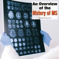 Technician looking at an MRI with overlay: An Overview of the History of MS