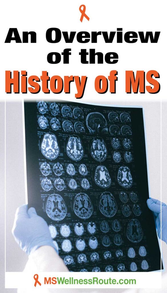 Technician looking at an MRI with headline: An Overview of the History of MS