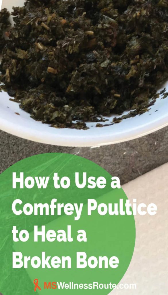 Learn how to use a comfrey poultice to heal a broken bone. | #comfreypoultice #holistichealing