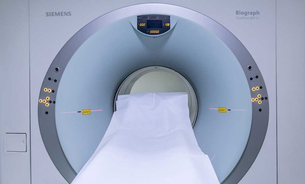 Magnetic resonance imaging (MRI)