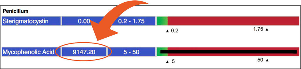 Mycotoxins results showing 9,147 for Penicillium.