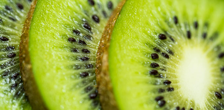 Slices of kiwi.