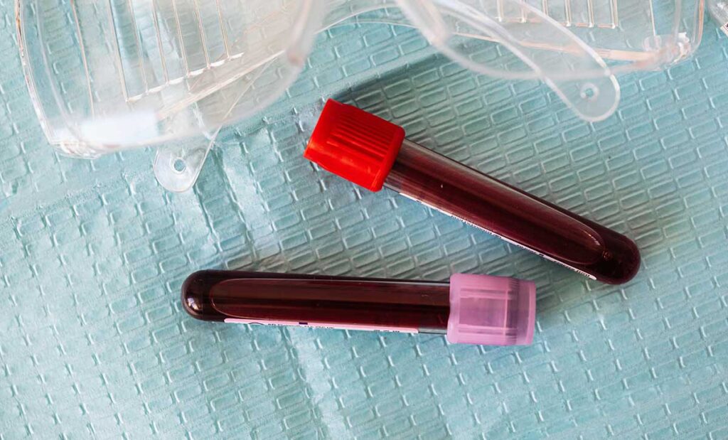 Two vials of blood